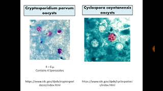 Para Findings 7 Cryptosporidium Cyclospora and Cystisospora in Stool with MZN stain [upl. by Carey]