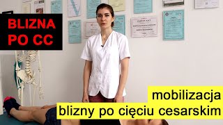 Blizna po cesarce mobilizacja blizny po cc [upl. by Adiene486]