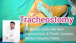 Tracheostomy सांस की नली में ऑपरेशन कर के पाइप जोड़ना Tracheostomy surgeon hospital doctor [upl. by Gnurt]