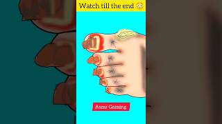 Asmr ingrow toenails treatment animation 😱 shorts youtubeshorts asmr animation [upl. by Artied771]