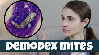 DEMODEX MITES ON YOUR SKIN DR DRAY [upl. by Weatherby386]