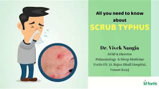 All about SCRUB TYPHUS  Dr Vivek Nangia [upl. by Mitch]