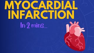 Myocardial Infarction in 2 mins [upl. by Cranston]