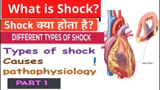 Types of shock in nursingpathology causes clinical features of shock full explanation [upl. by Ydnac]