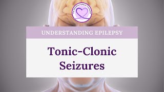 What are TonicClonic Seizures [upl. by Costin831]