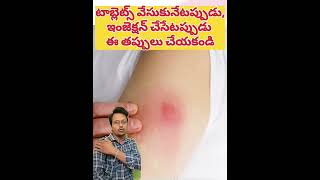 టాబ్లెట్స్ ఇలాగే వేసుకోవాలని తెలియక తప్పు చేశా healthtips doctor medicalprofession paramparik [upl. by Oirretno]