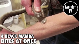 Surviving A Black Mamba Snake Bite  Venom Man [upl. by Akcinehs136]