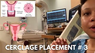 Cerclage Placement Procedure  3  Incompetent Cervix  14 Weeks Pregnant [upl. by Wernda509]