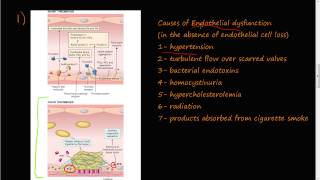 53  Thrombosis Virchows triad Endothelial Injury [upl. by Daryle]