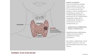 Nodus een knobbel in de schildklier [upl. by Atnuahc]