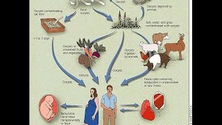 Congenital Toxoplasmosis [upl. by Yelruc]