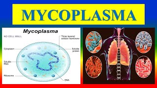 MYCOPLASMA  infection Diagnosis [upl. by Morgun734]