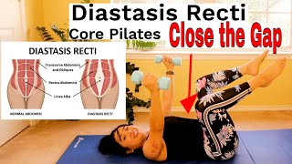 Diastasis Recti Core and Abdominal Strengthening Pilates Program with Dumbbells Progression [upl. by Bowe]