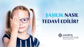 Şaşılık Nedir Tedavisi Nasıl Yapılır [upl. by Pasadis]