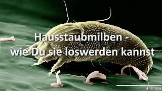 Hausstaubmilben – wie Du sie loswerden kannst [upl. by Irovi]