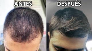 ¿El Secreto Para Recuperar El Pelo En 6 Meses [upl. by Quincy212]