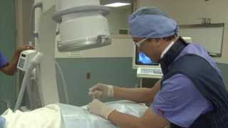 Ease Chronic Back Pain With Epidural Steroid Injections [upl. by Brenton]