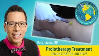 Stem Cell Prolotherapy treatment for knee osteoarthritis [upl. by Dulci927]