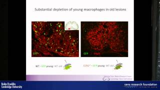 Myelin regeneration and ageing  Robin Franklin [upl. by Nerra180]