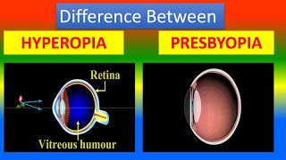 Difference between Hyperopia and Presbyopia [upl. by Wald]