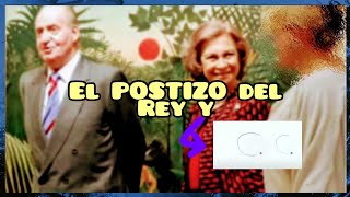 CC y el postizo en la nuca de Juan Carlos el rey emérito [upl. by Fredrick]