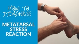 How to diagnose metatarsal stress reaction and fracture [upl. by Bortman]