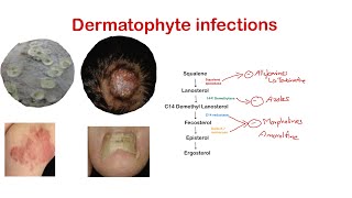 Dermatophytes Ring worm Superficial fungal infection Dermatology [upl. by Rossi]