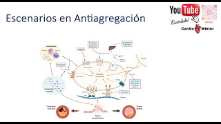 Escenarios en Antiagregación 📌📚🫀 [upl. by Artek]