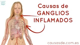 Causas de ganglios inflamados [upl. by Ainek93]