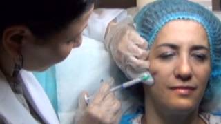 Fluid Facelift  with RADIESSE Dermal filler Demonstrated by Dr Nancy Labib [upl. by Tarrsus]