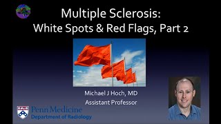 Multiple sclerosis – white spots and red flags  part 2  Mimics and Variants [upl. by Ashraf93]