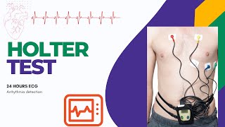 What is Holter Monitoring  24 hours ECG test  Holter test [upl. by Lednahc]