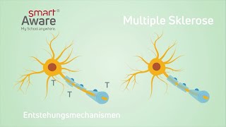 Multiple Sklerose Entstehungsmechanismen I Fachfortbildungen in der Pflege  smartAware [upl. by Osanna]