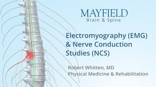 Electromyography EMG amp Nerve conduction studies NCS [upl. by Ellenrahc]