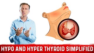 Hyperthyroid vs Hypothyroid Explained By Dr Berg [upl. by Dusa]