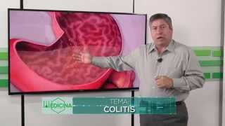 Medicina para todos Colitis [upl. by Timus]