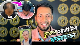 চুল ফিরে পেয়ে অনেক খুশি  Hair Transplant Bangladesh  হেয়ার ট্রান্সপ্লান্ট রেজাল্ট বাংলাদেশ [upl. by Raney470]