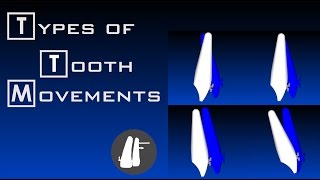 Types Of Tooth Movement  Essential Biomechanics [upl. by Cocks99]