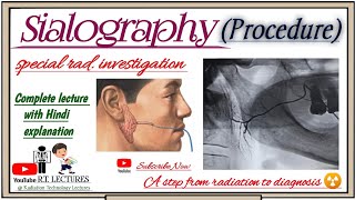 Sialography Procedure Complete Lecture Sialography radiology complete video Lecture in hindi [upl. by Nallad]