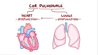 Cor Pulmonale [upl. by Egwin914]