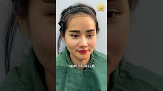 Love Shaped Hair Line Transplant  HAIR TRANSPLANT MALAYSIA [upl. by Iggep]