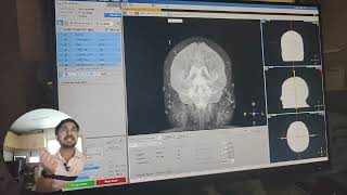 Venography MRI Contrast Explained MRVStep by Step on MRV plain as well as ContrastPart1 [upl. by Dowzall]