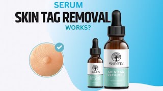 Skinfix Skin Tag Removal Review  Serum Skin Tags  Benefits Ingredients How to use [upl. by Eiznekcam185]