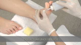 Cómo eliminar los callos de los pies  Tips para pedicuría [upl. by Euqinaj]