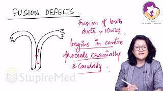 Clinical shots of Mullerian Anomalies by Dr Shonali Chandra [upl. by Yance650]