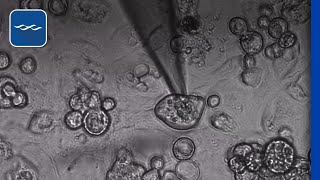 Spontaneous beating of stem cell derived cardiomyocytes [upl. by Maguire800]