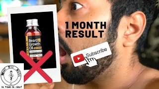 USTRAA Beard Growth Oil Honest Review 1 month later  how to grow Beard [upl. by Atinej]