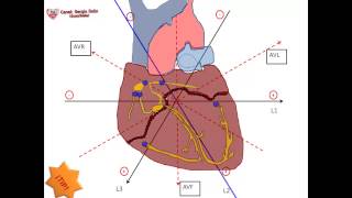 2La forma mas sencilla de sacar eje cardiaco Ordenando el Triangulo de Einthoven [upl. by Aztiram500]