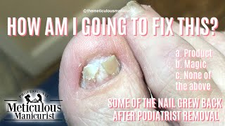 Big Toenail Transformation Pedicure Tutorial After Ingrown Toenail Removal [upl. by Hendrika305]