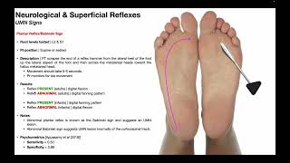 Plantar Reflex amp the Babinski Sign EXPLAINED [upl. by Sachiko310]